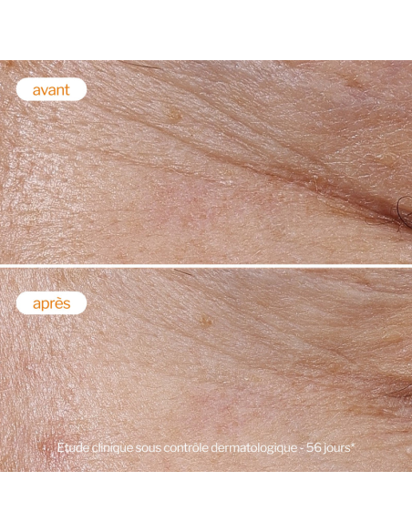 Novexpert Crème Légère à la Vitamine C