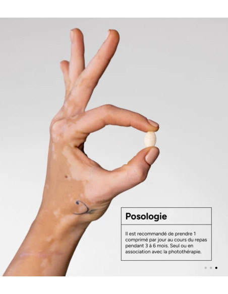 ACM Vitix Comprimés B/30