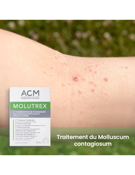 ACM Molutrex Solution Pour Application Locale Cutanée